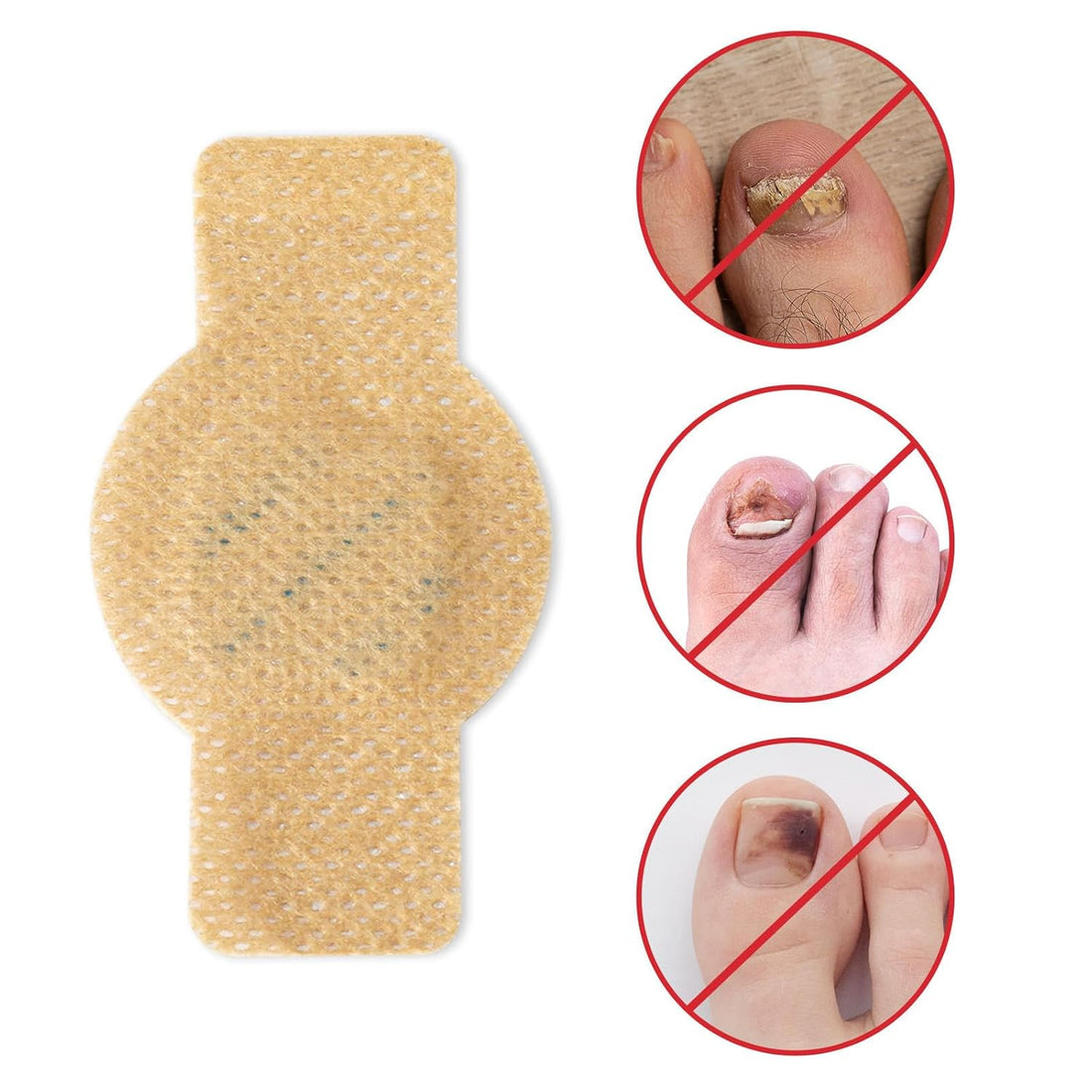 NailHeal™ – Fungal Nail Repair Patches 🌿💅 (Buy 1 Get 1 Free 🔥🔥)